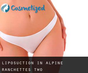 Liposuction in Alpine Ranchettes Two