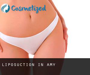 Liposuction in Amy