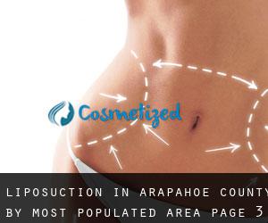 Liposuction in Arapahoe County by most populated area - page 3