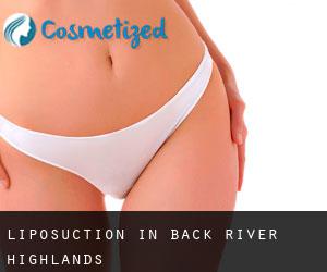 Liposuction in Back River Highlands
