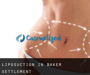 Liposuction in Baker Settlement