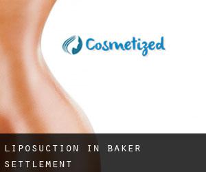Liposuction in Baker Settlement
