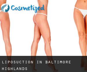Liposuction in Baltimore Highlands