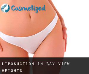 Liposuction in Bay View Heights