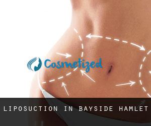 Liposuction in Bayside Hamlet