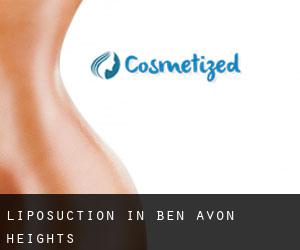 Liposuction in Ben Avon Heights