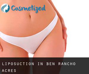 Liposuction in Ben Rancho Acres