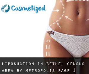 Liposuction in Bethel Census Area by metropolis - page 1