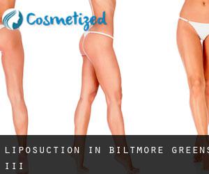 Liposuction in Biltmore Greens III