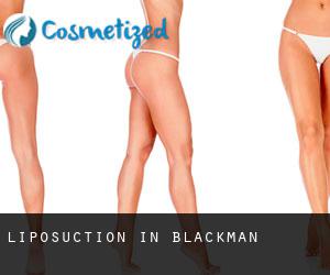 Liposuction in Blackman
