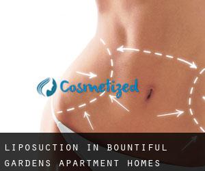 Liposuction in Bountiful Gardens Apartment Homes