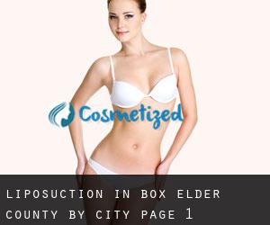 Liposuction in Box Elder County by city - page 1