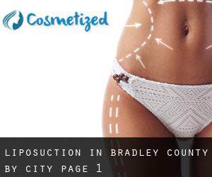 Liposuction in Bradley County by city - page 1