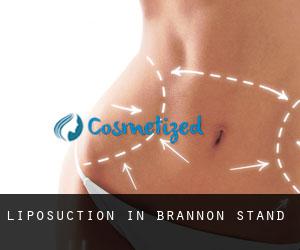 Liposuction in Brannon Stand