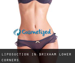 Liposuction in Brixham Lower Corners