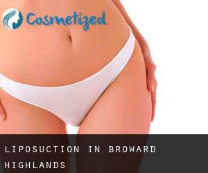 Liposuction in Broward Highlands