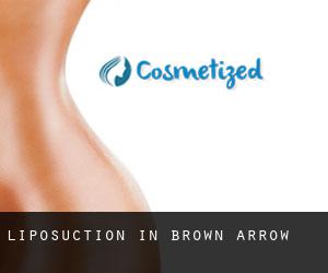 Liposuction in Brown Arrow