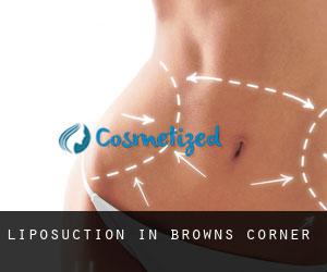 Liposuction in Browns Corner