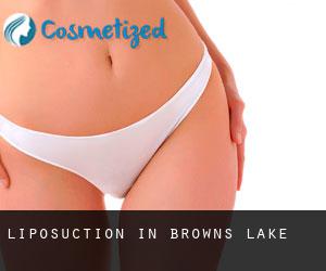 Liposuction in Browns Lake