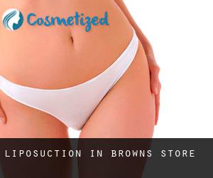 Liposuction in Browns Store