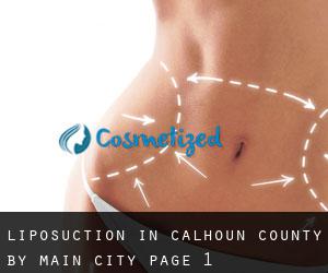 Liposuction in Calhoun County by main city - page 1