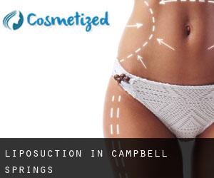 Liposuction in Campbell Springs