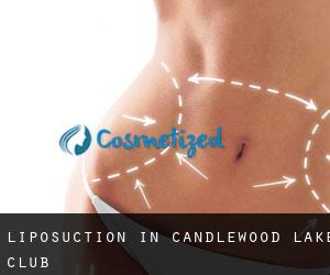 Liposuction in Candlewood Lake Club