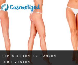 Liposuction in Cannon Subdivision