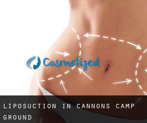 Liposuction in Cannons Camp Ground
