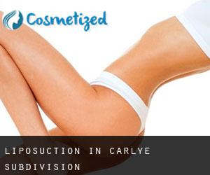 Liposuction in Carlye Subdivision