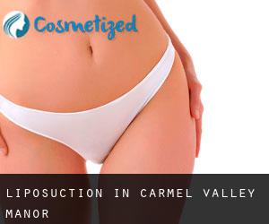 Liposuction in Carmel Valley Manor