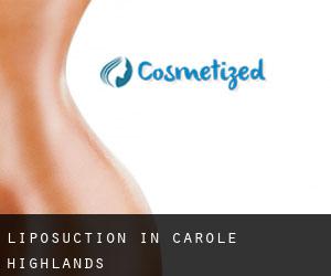 Liposuction in Carole Highlands
