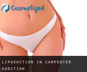 Liposuction in Carpenter Addition