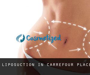 Liposuction in Carrefour Place