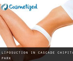 Liposuction in Cascade-Chipita Park