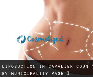 Liposuction in Cavalier County by municipality - page 1