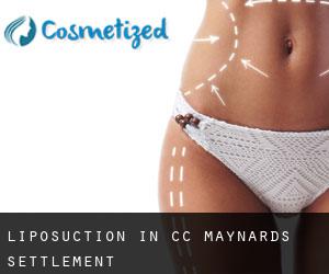 Liposuction in CC Maynards Settlement