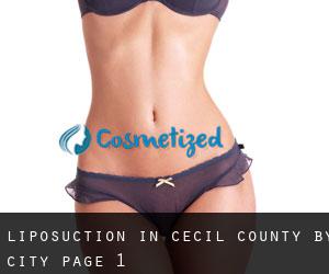Liposuction in Cecil County by city - page 1