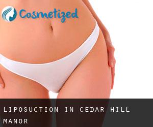Liposuction in Cedar Hill Manor
