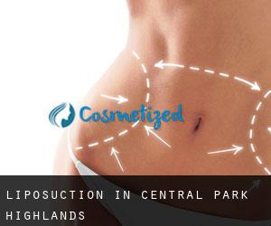 Liposuction in Central Park Highlands