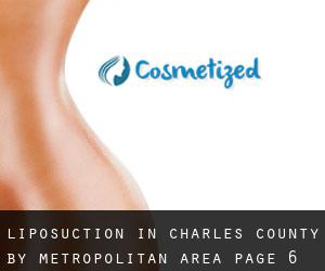 Liposuction in Charles County by metropolitan area - page 6