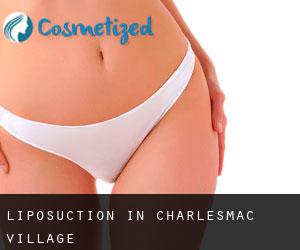 Liposuction in Charlesmac Village