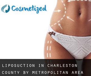 Liposuction in Charleston County by metropolitan area - page 1