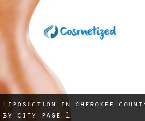 Liposuction in Cherokee County by city - page 1