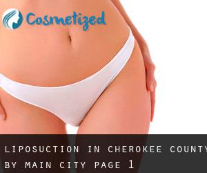 Liposuction in Cherokee County by main city - page 1