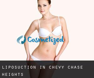 Liposuction in Chevy Chase Heights