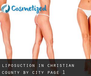 Liposuction in Christian County by city - page 1