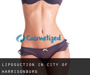 Liposuction in City of Harrisonburg