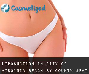 Liposuction in City of Virginia Beach by county seat - page 1
