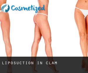 Liposuction in Clam